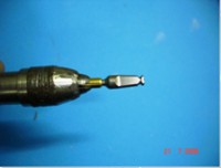 /album/galeria-de-fotos-carga-imediata-apos-exodontia-atraumatica-/carga-imediata-com-exodontia-atraumatica14-jpg/